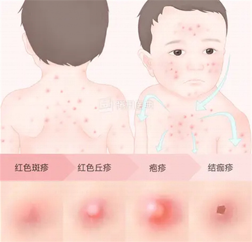 图片细节